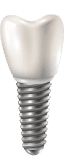 dental implant