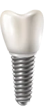 Graphic of a dental implant