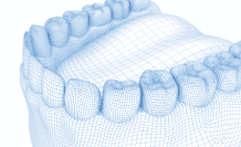 3d scan of teeth